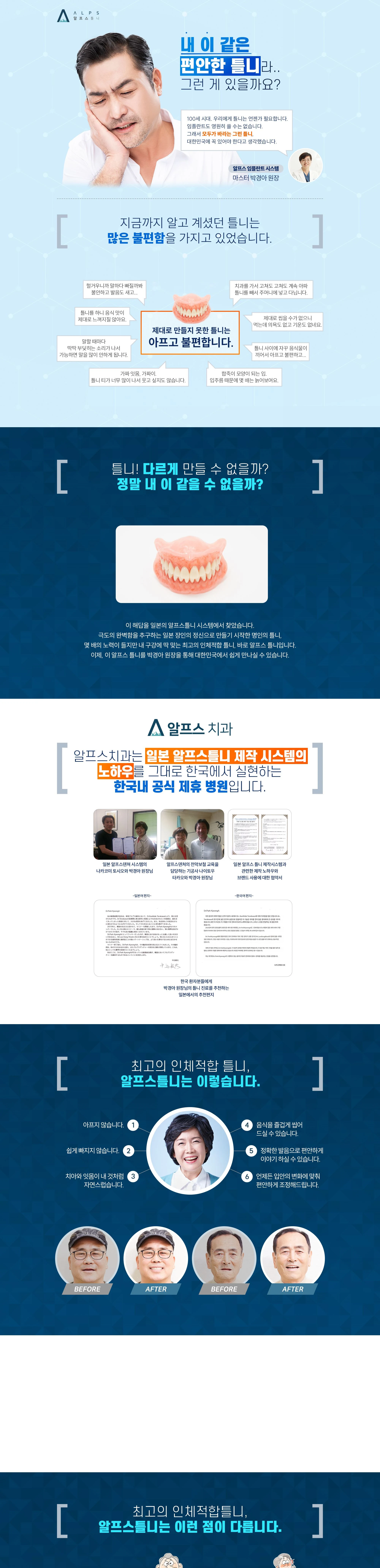 알프스틀니 소개 상세 안내 이미지 1