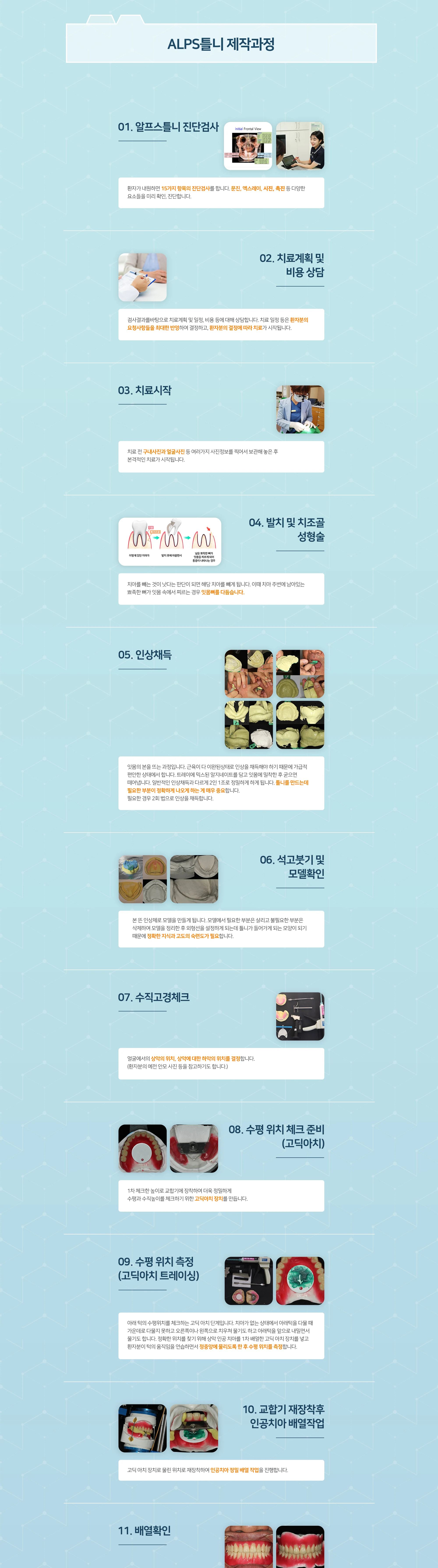 알프스틀니 제작과정 상세 안내 이미지 2