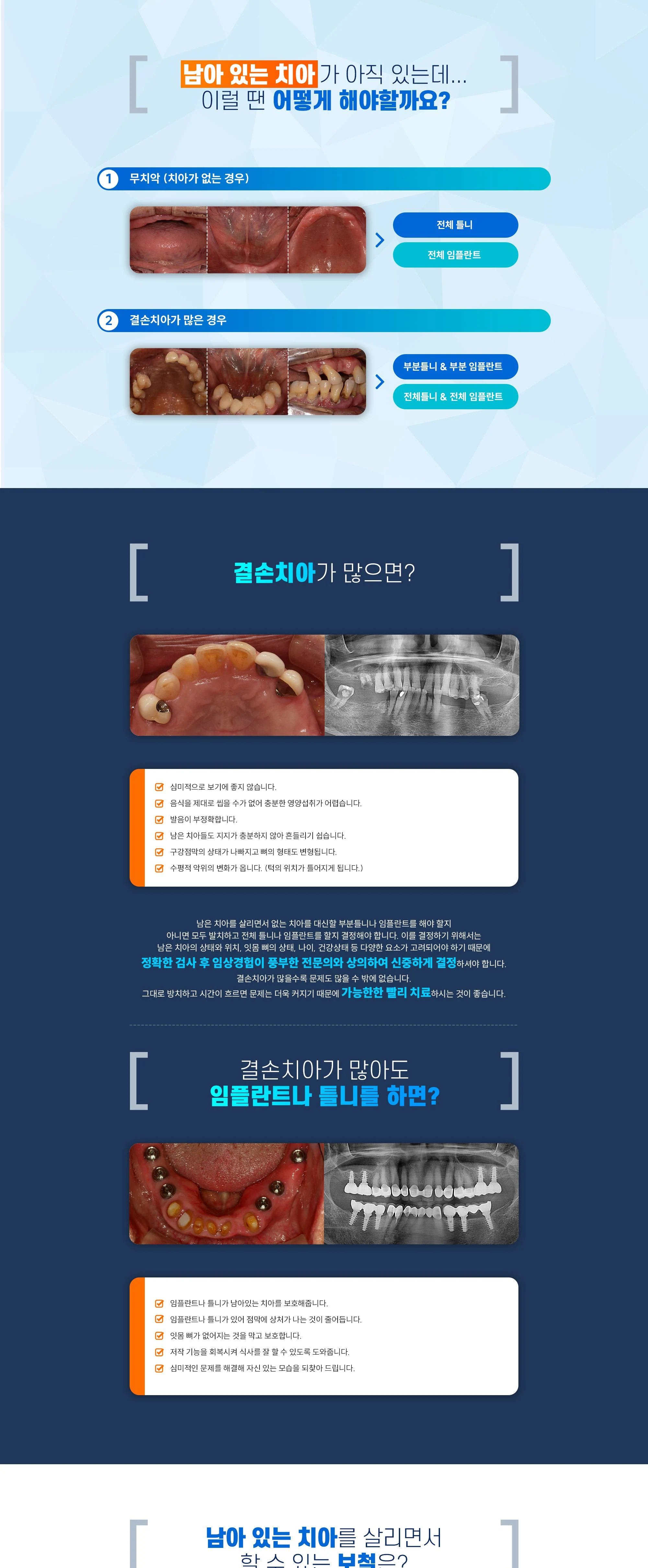 전체틀니와 부분틀니 상세 안내 이미지 1