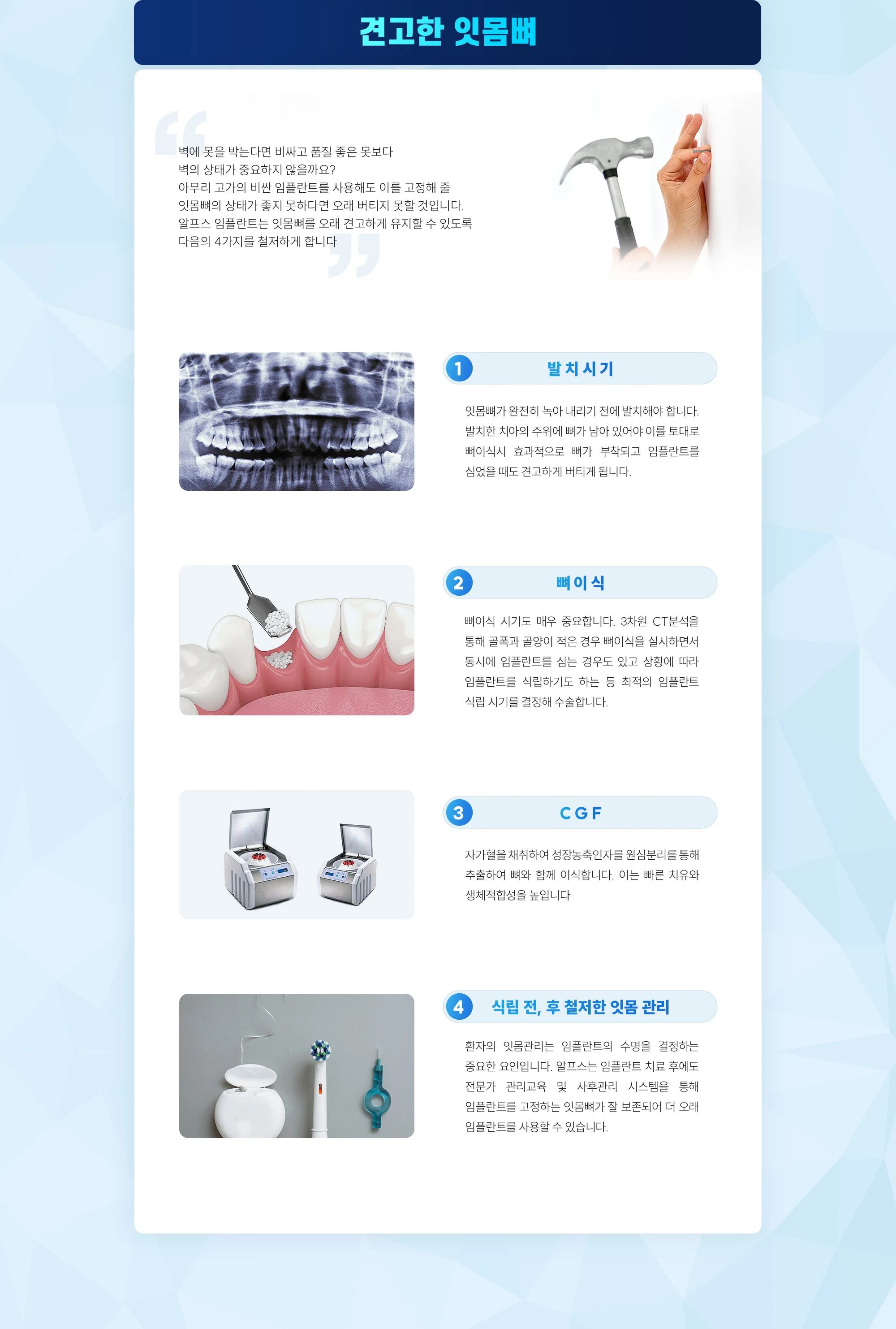 알프스 임플란트의 특별함 상세 안내 이미지 3