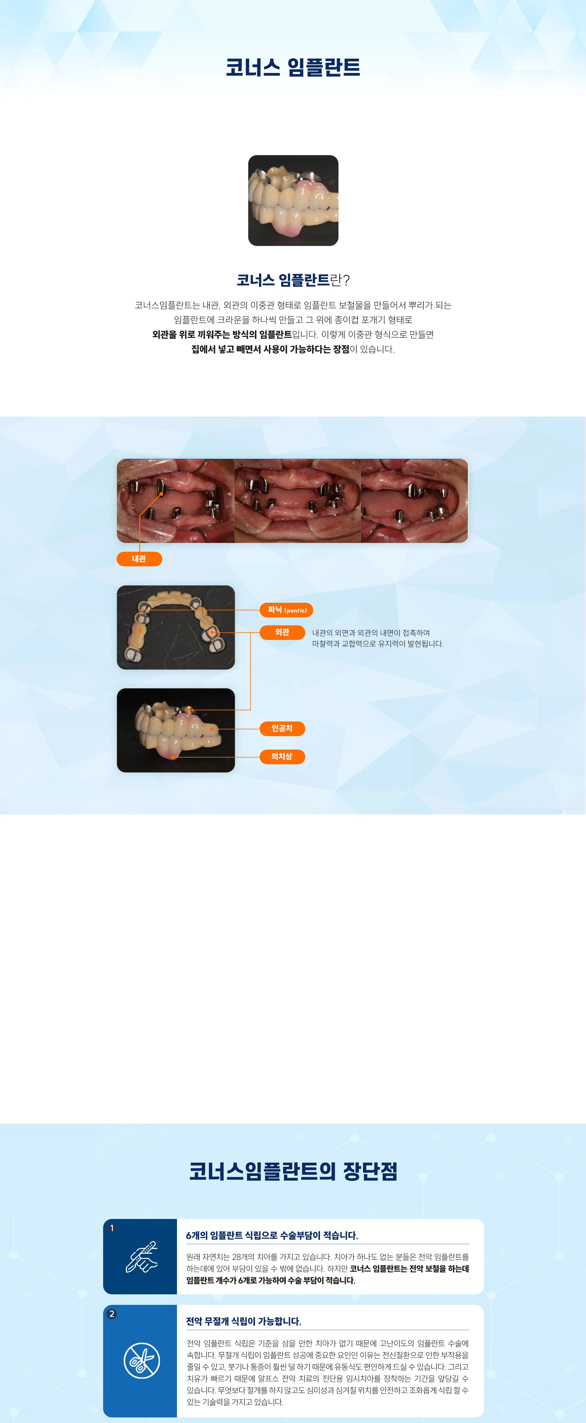 코너스 임플란트 상세 안내 이미지 1