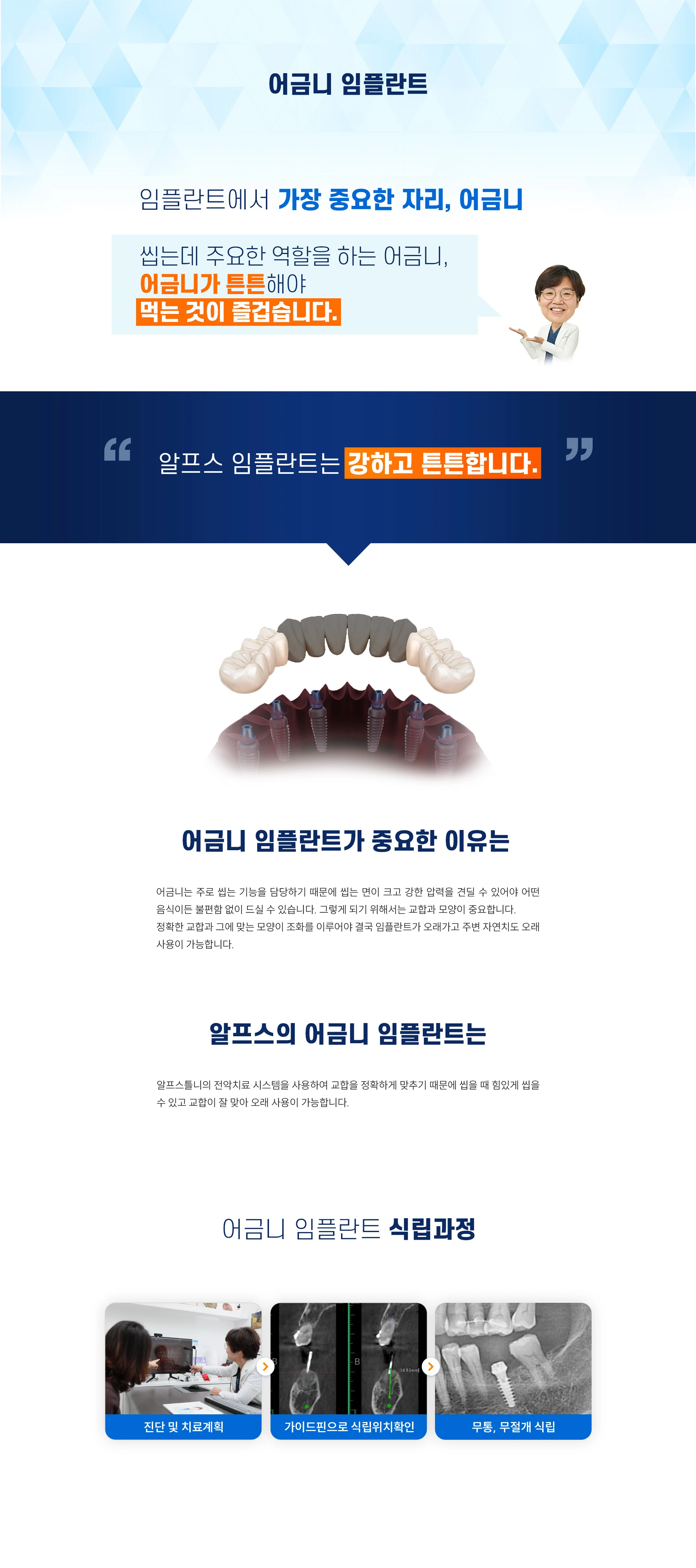 어금니 임플란트 상세 안내 이미지 1