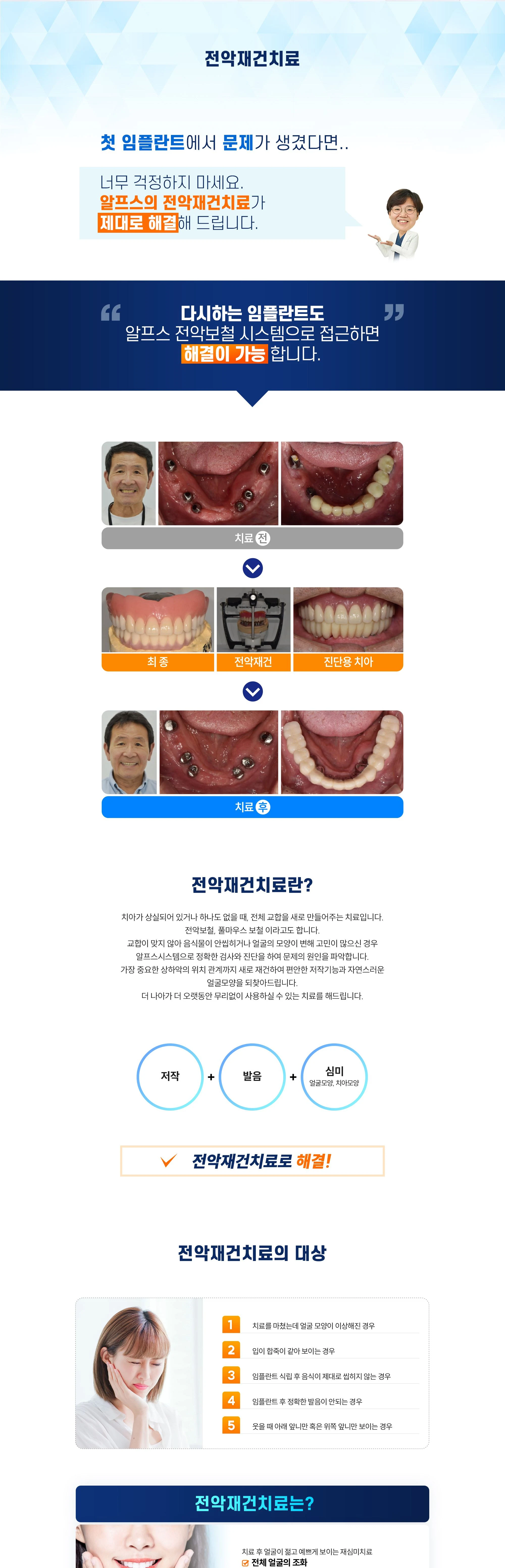 전악재건치료 상세 안내 이미지 1