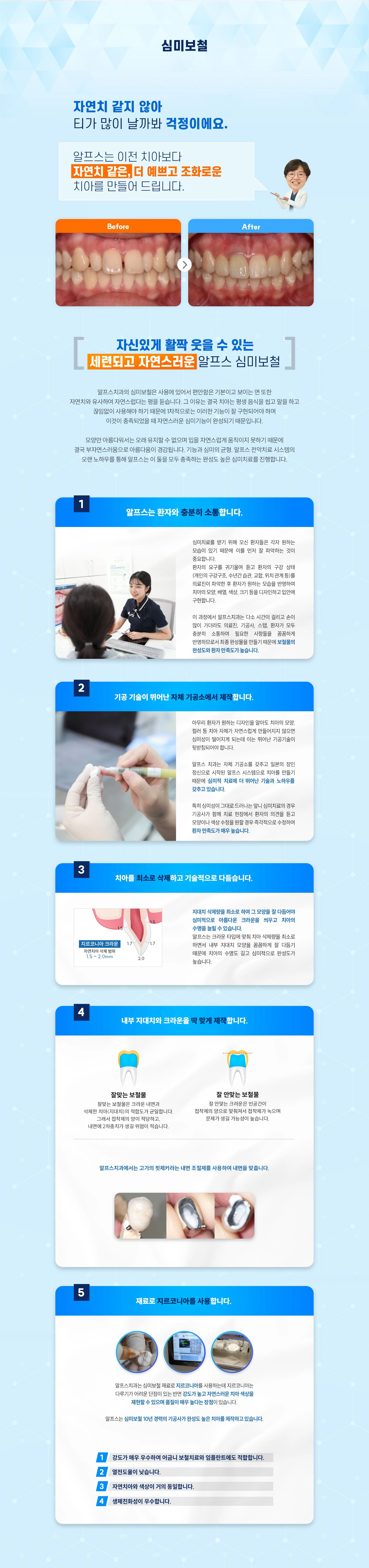심미보철 상세 안내 이미지 1