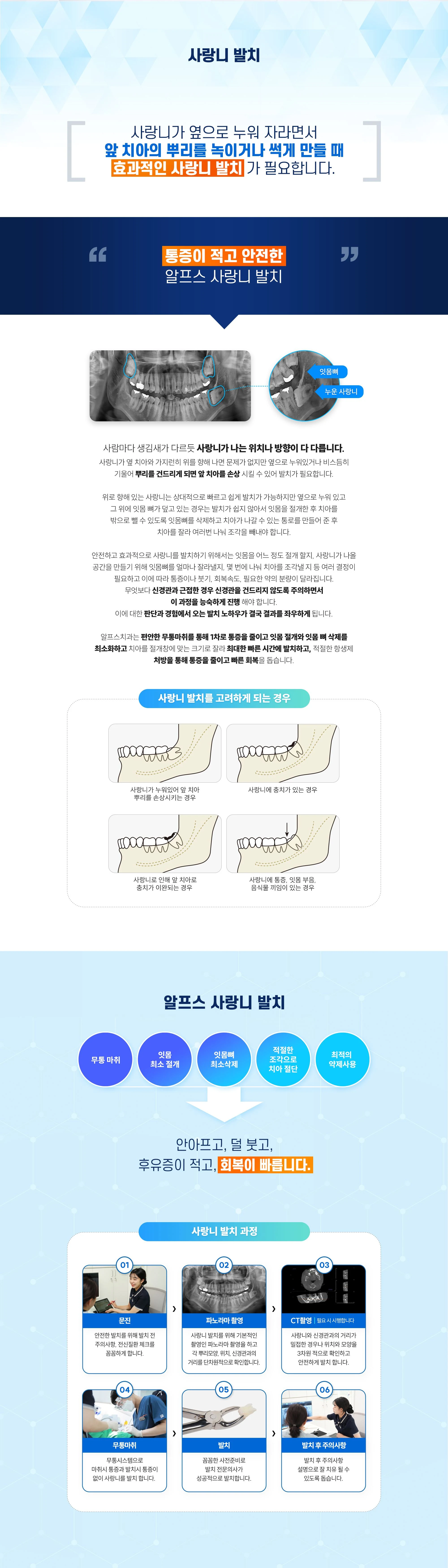 사랑니 발치 상세 안내 이미지 1