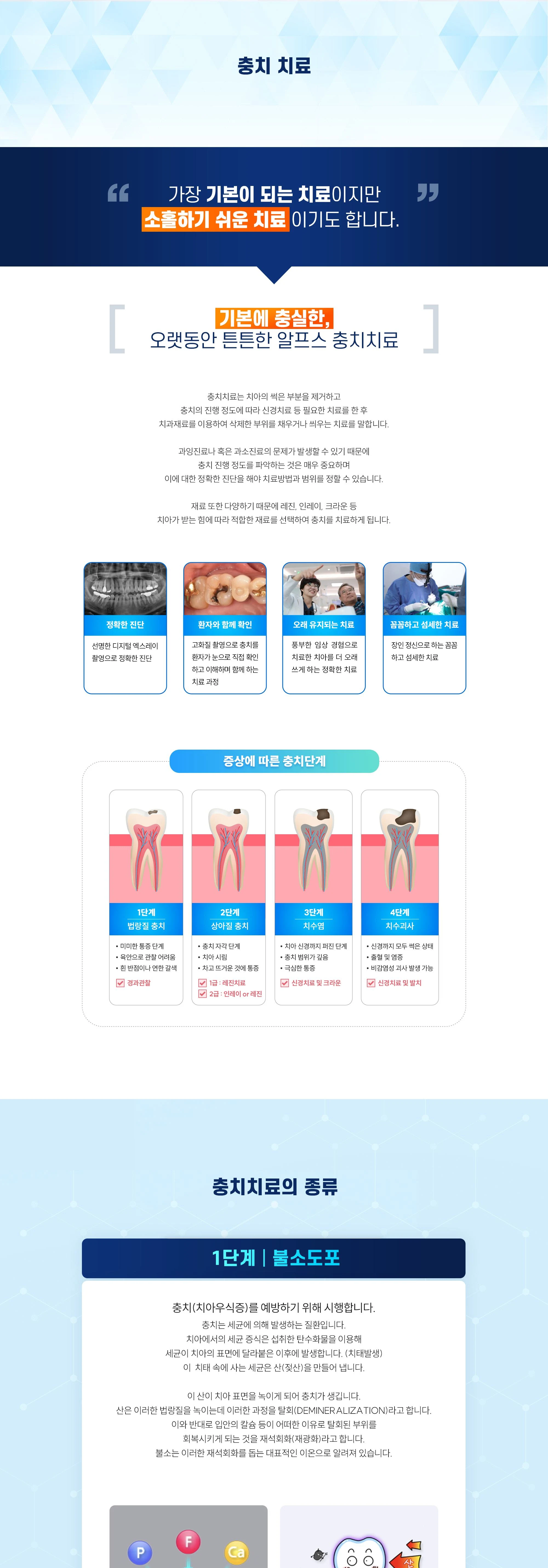 충치 치료 상세 안내 이미지 1