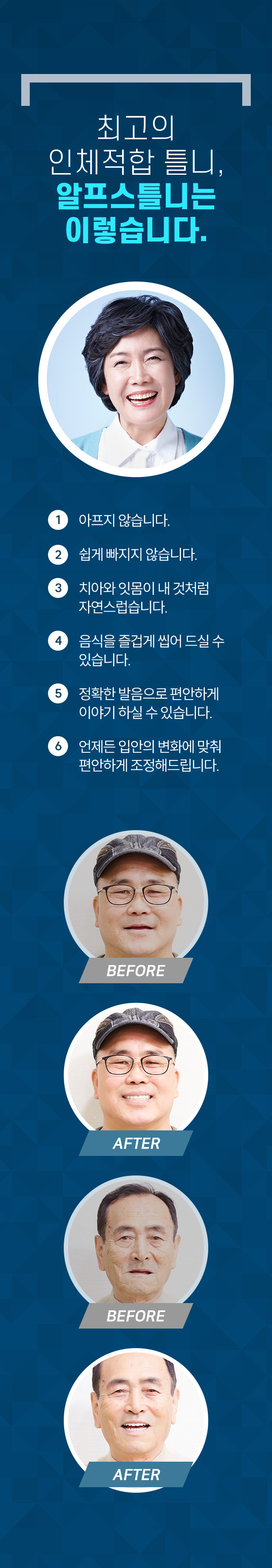 알프스틀니 소개
