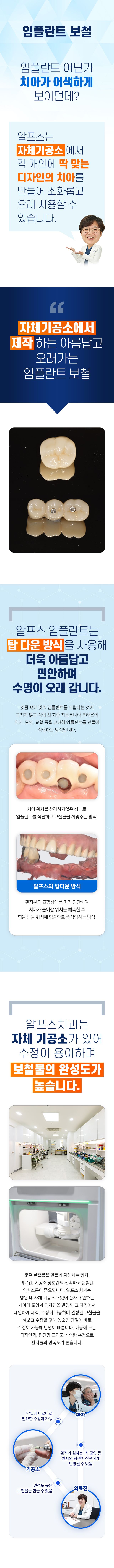 알프스 임플란트의 특별함