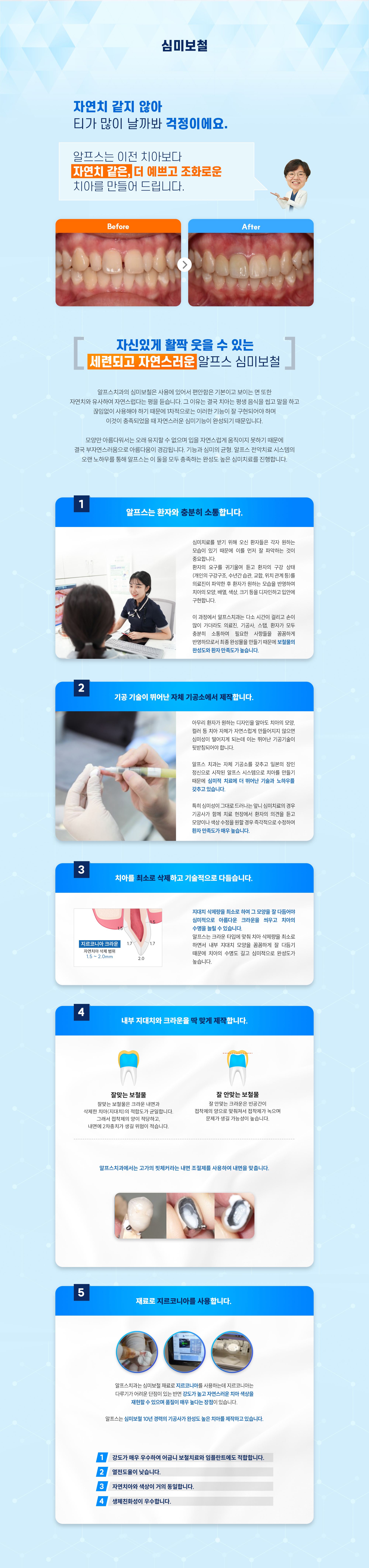 심미보철